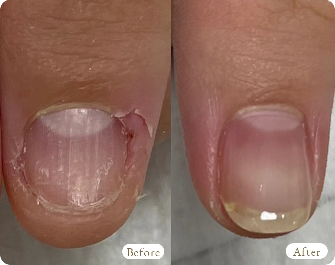 烏丸御池の自爪に優しいジェルネイルサロンPlaisir-Nail-｜削らないパラジェルで薄い爪・二枚爪・弱い爪も安心してネイルを楽しめる大人女性向けネイルサロン