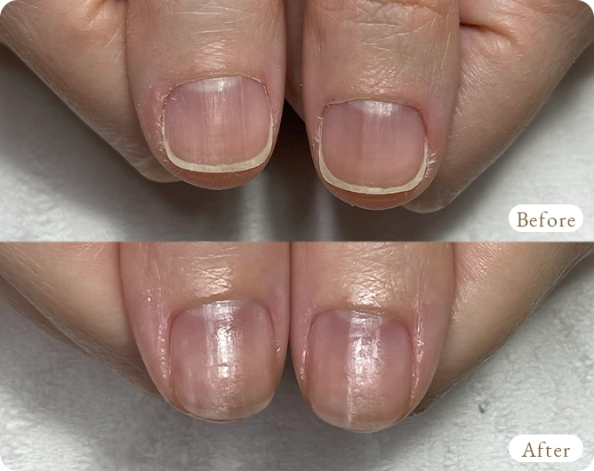 烏丸御池の自爪に優しいジェルネイルサロンPlaisir-Nail-｜削らないパラジェルで薄い爪・二枚爪・弱い爪も安心してネイルを楽しめる大人女性向けネイルサロン