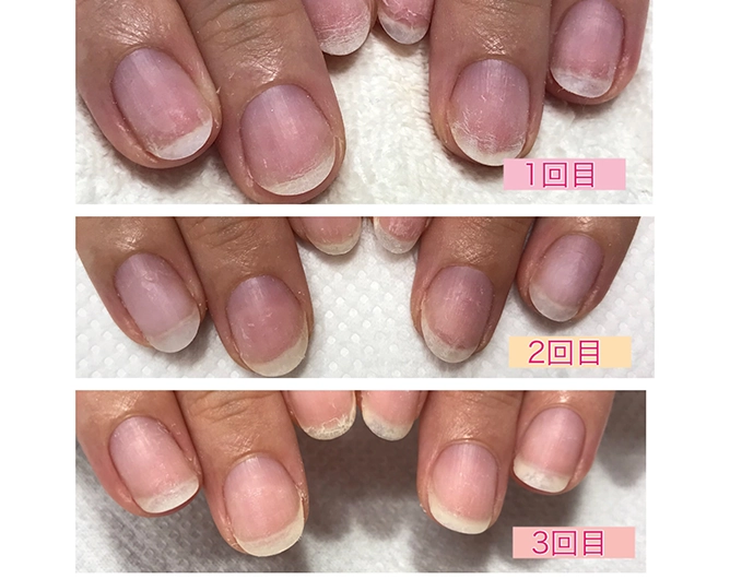 烏丸御池の自爪に優しいジェルネイルサロンPlaisir-Nail-｜削らないパラジェルで薄い爪・二枚爪・弱い爪も安心してネイルを楽しめる大人女性向けネイルサロン